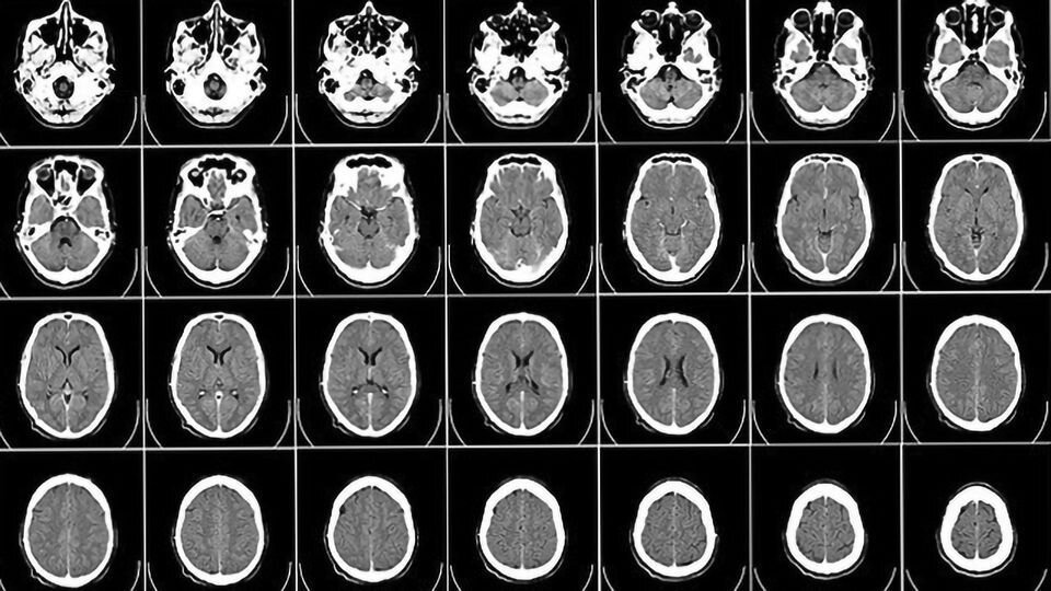 Quantification of Brain Age by Functional MRI Data: Complexity and Functional Connectivity
